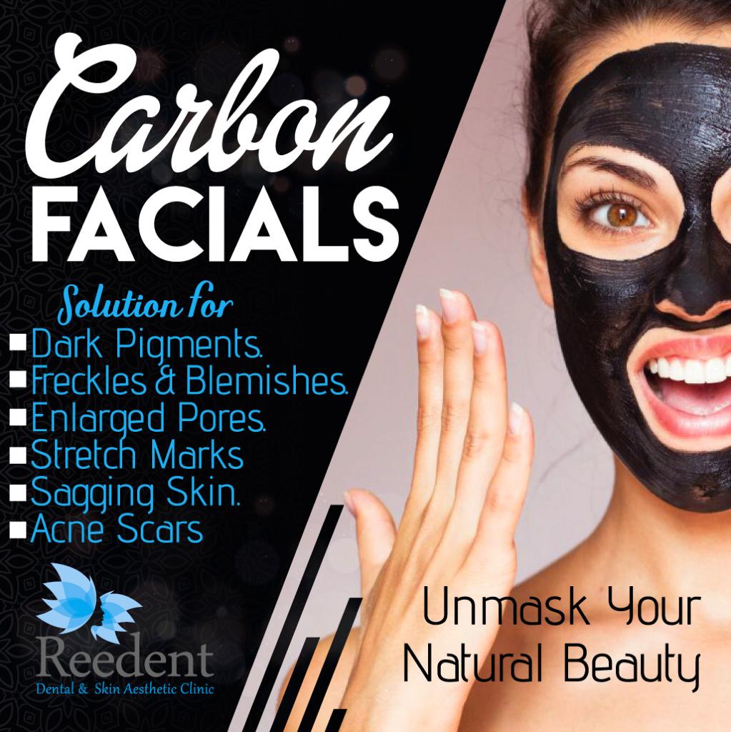 Carbon Facials